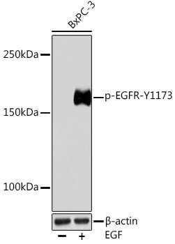 Phospho-EGFR (Tyr1173) Antibody in Western Blot (WB)