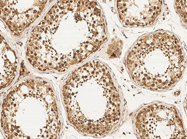 DZIP1 Antibody in Immunohistochemistry (Paraffin) (IHC (P))