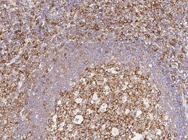 CCR1 Antibody in Immunohistochemistry (Paraffin) (IHC (P))