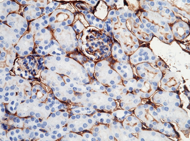 ICAM-1 Antibody in Immunohistochemistry (Paraffin) (IHC (P))