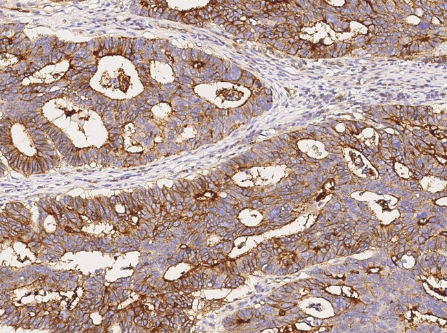IFITM1 Antibody in Immunohistochemistry (Paraffin) (IHC (P))