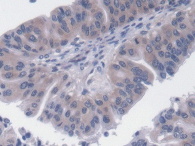 UCP2 Antibody in Immunohistochemistry (Paraffin) (IHC (P))