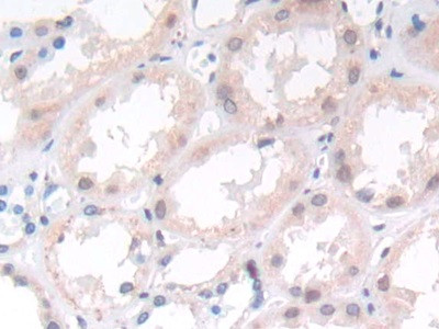 ST14 Antibody in Immunohistochemistry (Paraffin) (IHC (P))