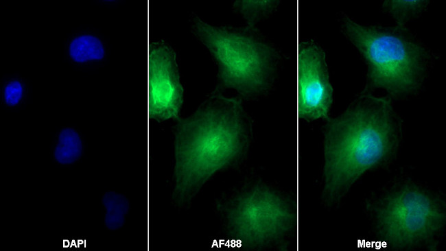 SFRP4 Antibody in Immunocytochemistry (ICC/IF)