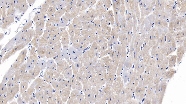 SEMA5B Antibody in Immunohistochemistry (Paraffin) (IHC (P))