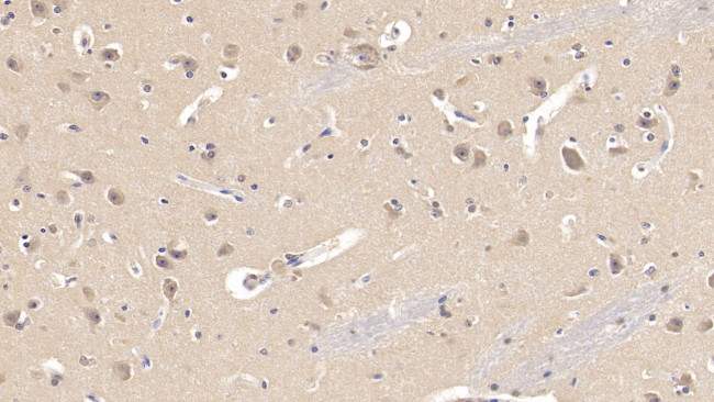 SEMA3A Antibody in Immunohistochemistry (Paraffin) (IHC (P))