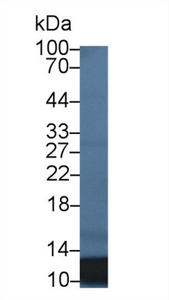 S100A12 Antibody in Western Blot (WB)
