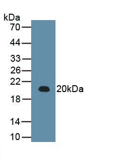 RARS Antibody in Western Blot (WB)
