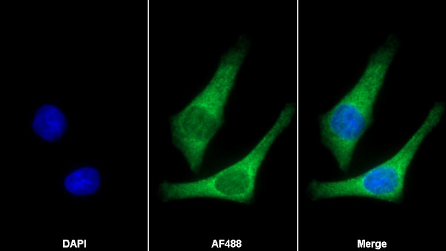 Periostin Antibody in Immunocytochemistry (ICC/IF)