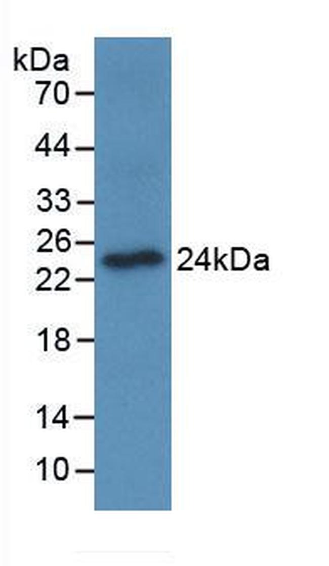 OSCAR Antibody in Western Blot (WB)