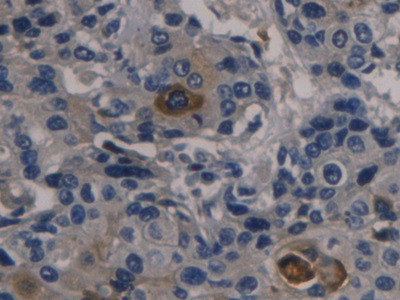 ORM2 Antibody in Immunohistochemistry (Paraffin) (IHC (P))