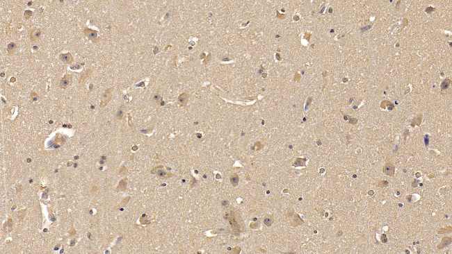 MMP25 Antibody in Immunohistochemistry (Paraffin) (IHC (P))