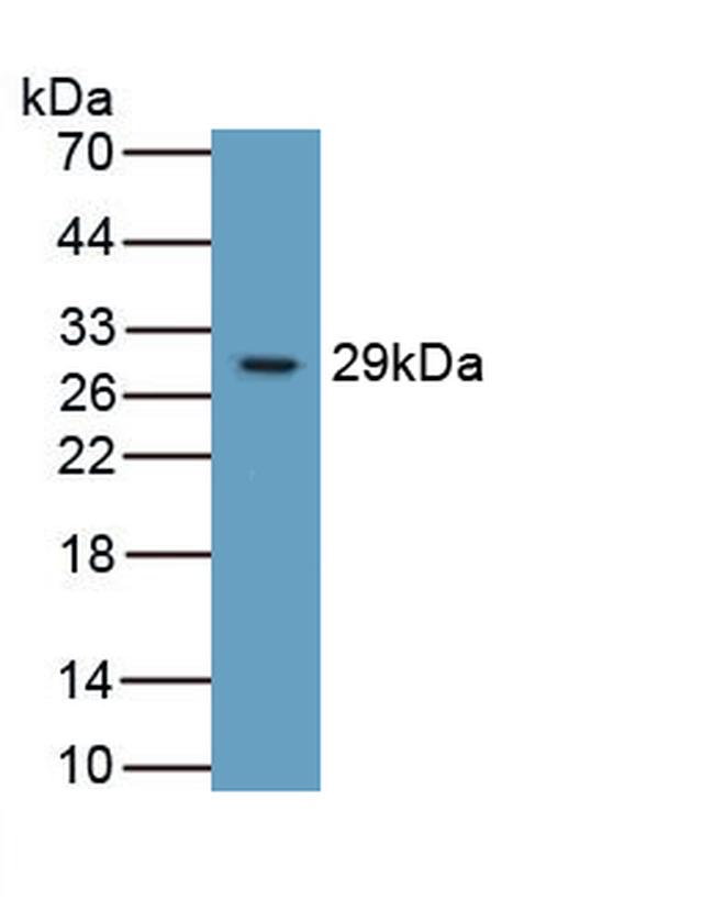 ITGB6 Antibody in Western Blot (WB)