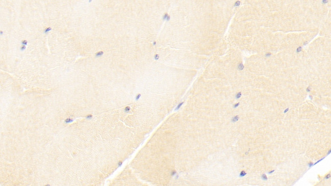 ISLR Antibody in Immunohistochemistry (Paraffin) (IHC (P))