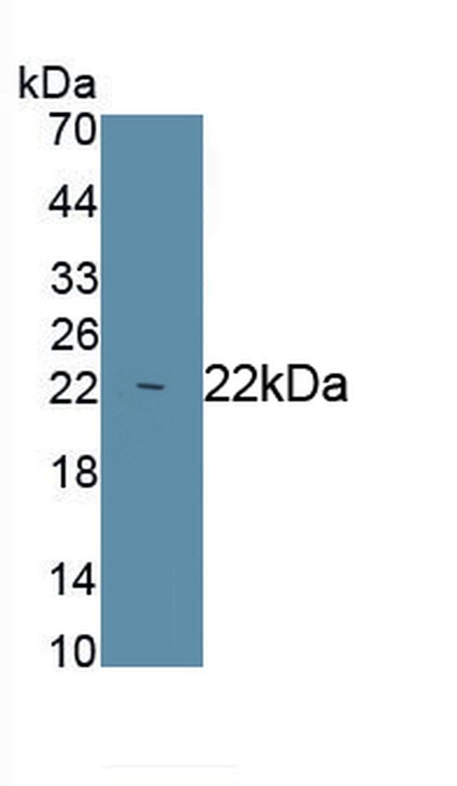 iNOS Antibody in Western Blot (WB)