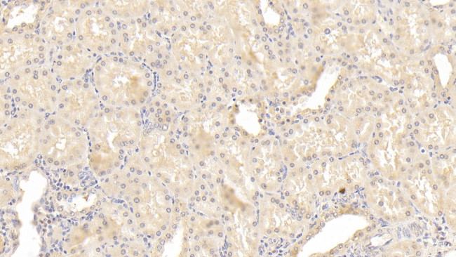 INHBB Antibody in Immunohistochemistry (Paraffin) (IHC (P))
