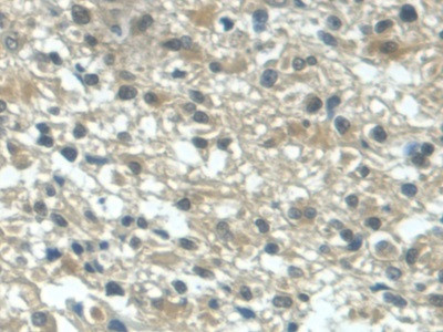 TGF alpha Antibody in Immunohistochemistry (Paraffin) (IHC (P))