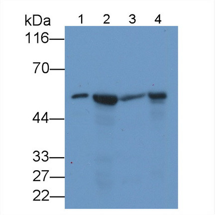 NAMPT Antibody in Western Blot (WB)