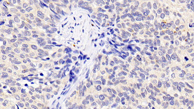 INHA Antibody in Immunohistochemistry (Paraffin) (IHC (P))