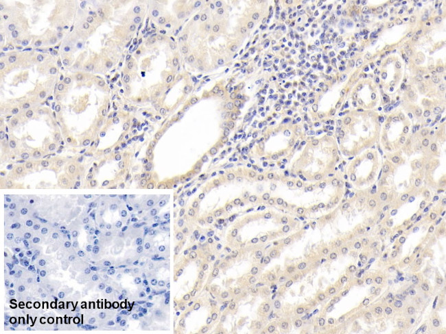 IL-18 Antibody in Immunohistochemistry (Paraffin) (IHC (P))
