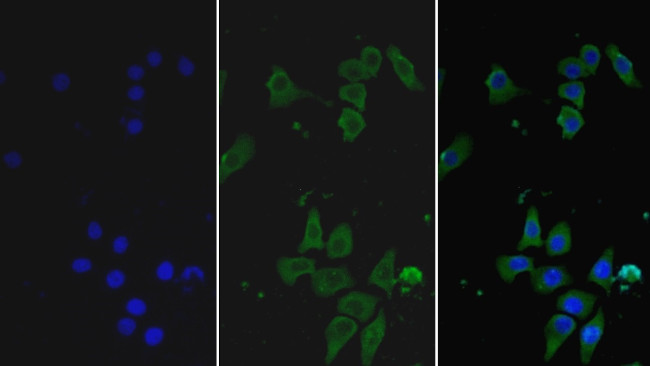 HPa1 Antibody in Immunocytochemistry (ICC/IF)