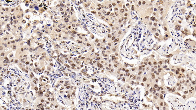 HDAC1 Antibody in Immunohistochemistry (Paraffin) (IHC (P))
