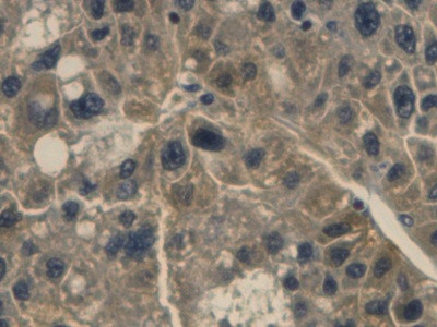 Haptoglobin Antibody in Immunohistochemistry (Paraffin) (IHC (P))