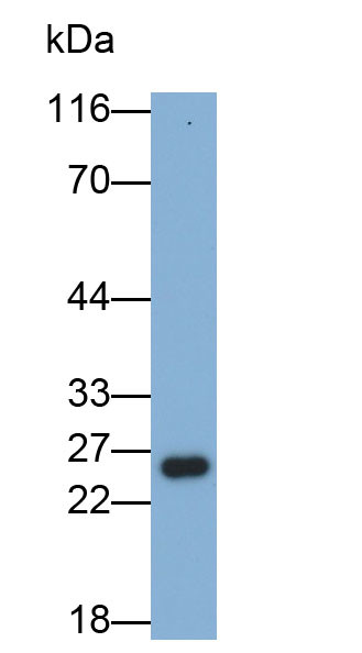 GSTA1 Antibody in Western Blot (WB)