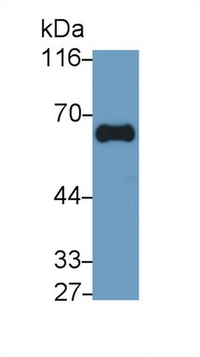 GGT1 Antibody in Western Blot (WB)