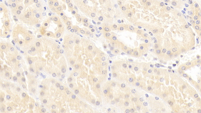 SCNN1G Antibody in Immunohistochemistry (Paraffin) (IHC (P))