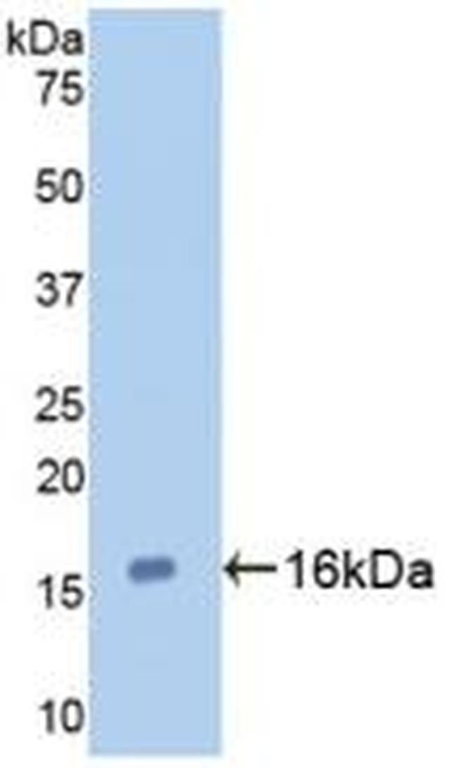 Galectin 7 Antibody in Western Blot (WB)