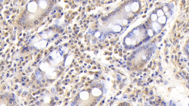 FIBB Antibody in Immunohistochemistry (Paraffin) (IHC (P))