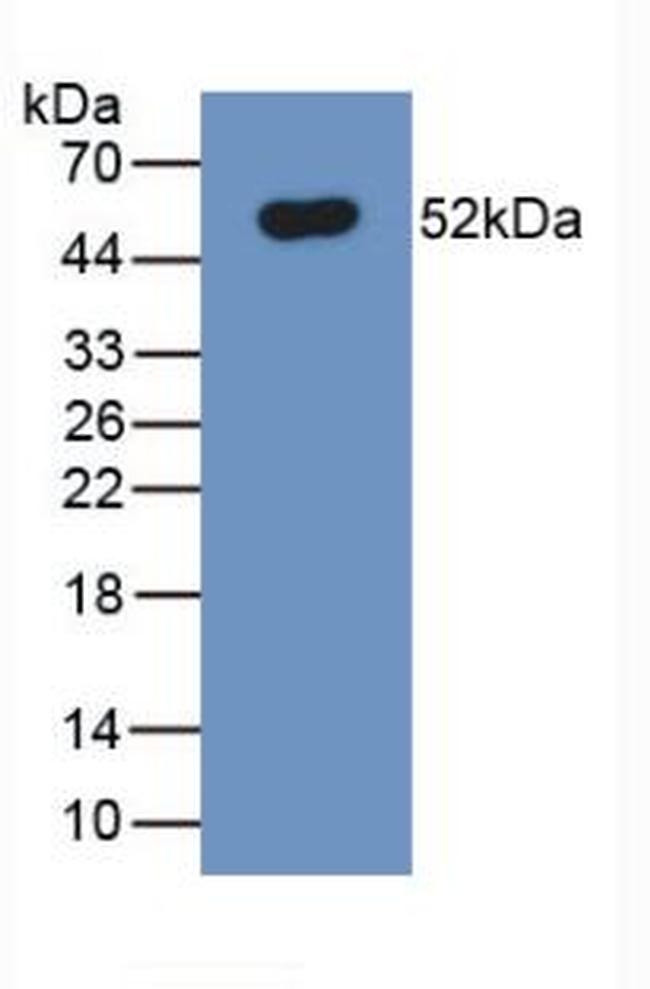 Ferroportin Antibody in Western Blot (WB)