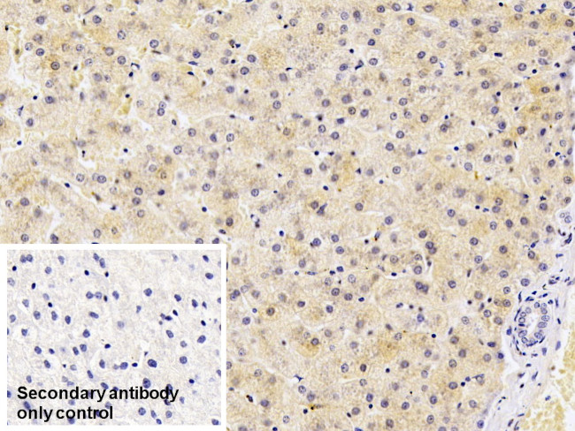 Ferritin Light Chain Antibody in Immunohistochemistry (Paraffin) (IHC (P))
