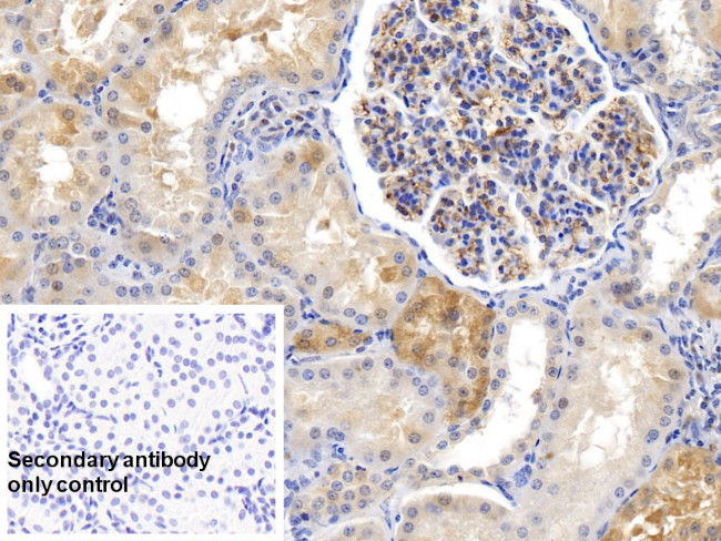 Ferritin Heavy Chain Antibody in Immunohistochemistry (Paraffin) (IHC (P))