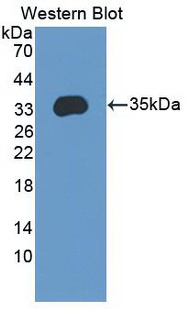 ENPP2 Antibody in Western Blot (WB)