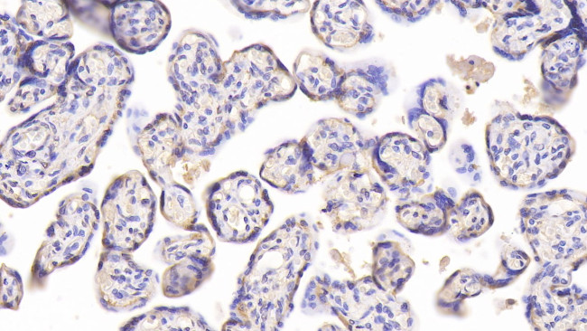 Chemerin Antibody in Immunohistochemistry (Paraffin) (IHC (P))