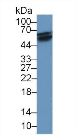 RANK (CD265) Antibody in Western Blot (WB)