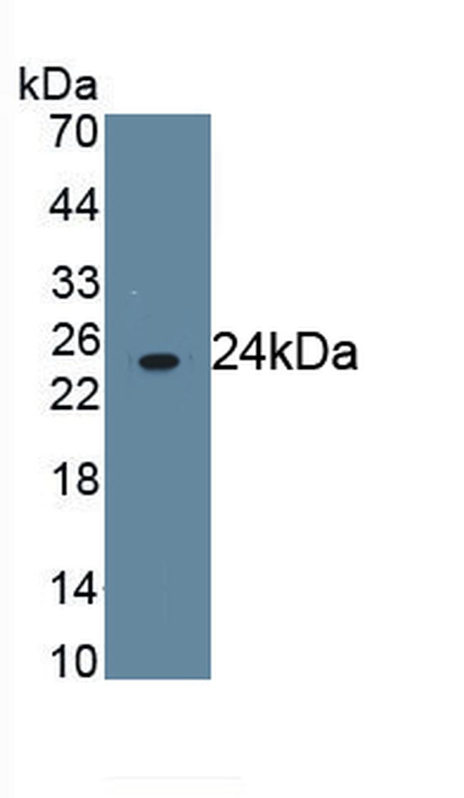 CD16b (FCGR3B) Antibody in Western Blot (WB)
