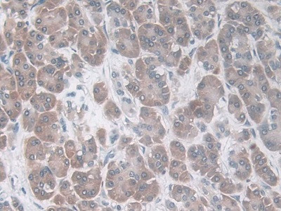 CCL20 Antibody in Immunohistochemistry (Paraffin) (IHC (P))