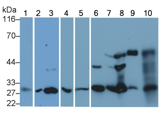 Cathepsin K Antibody in Western Blot (WB)