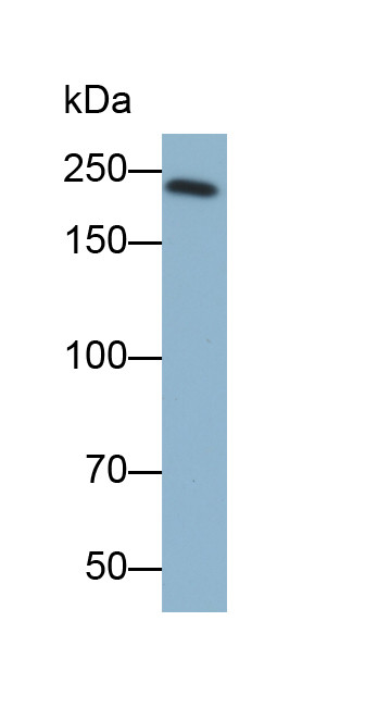 MYH7 Antibody in Western Blot (WB)
