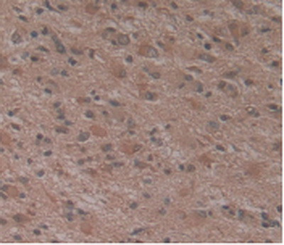 Atrophin 1 Antibody in Immunohistochemistry (Paraffin) (IHC (P))