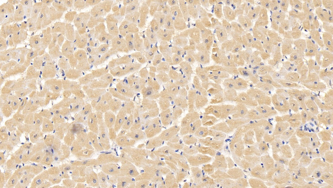 VDAC Antibody in Immunohistochemistry (Paraffin) (IHC (P))