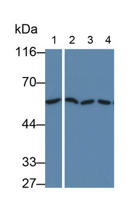 ALOX5 Antibody in Western Blot (WB)