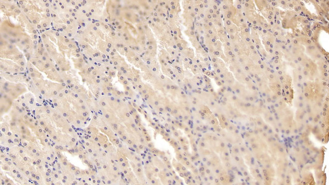 ADAMTS9 Antibody in Immunohistochemistry (Paraffin) (IHC (P))