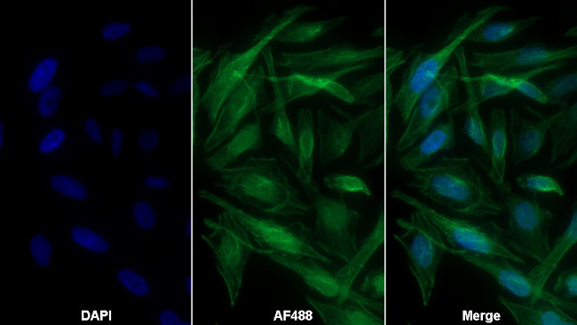 A1BG Antibody in Immunocytochemistry (ICC/IF)