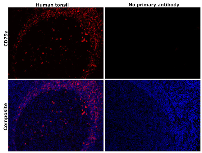 CD79a Antibody in Immunohistochemistry (Paraffin) (IHC (P))