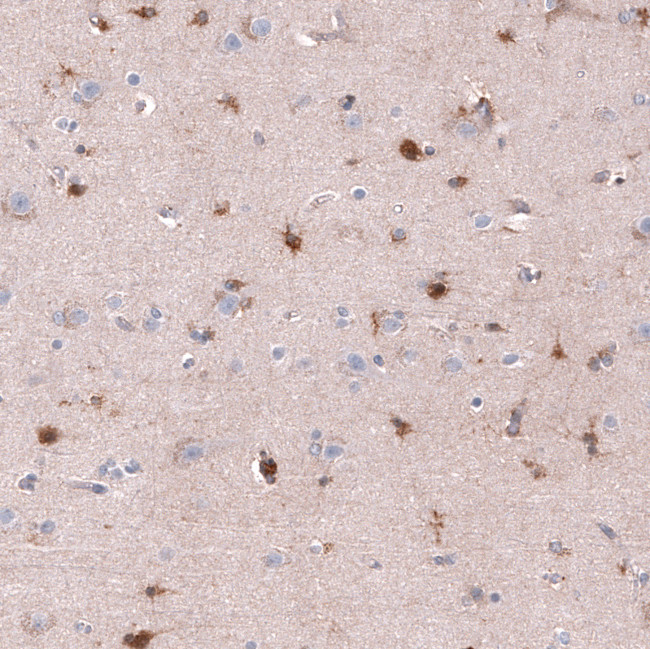 CHI3L1 Antibody in Immunohistochemistry (Paraffin) (IHC (P))