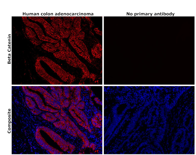 beta Catenin Antibody in Immunohistochemistry (Paraffin) (IHC (P))